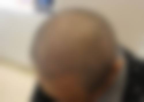 南京新生植发美容医院擅长项目