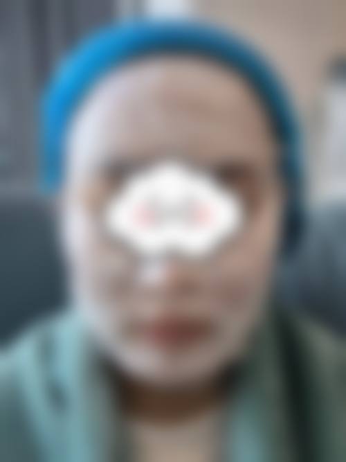 泸州华伊佰颜整形医院常见问题FAQ