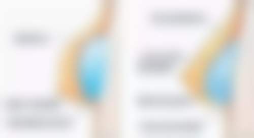 长沙美诺美和医疗美容诊所常见问题FAQ