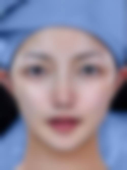 西安利兹美医疗美容诊所(轻医美)常见问题FAQ