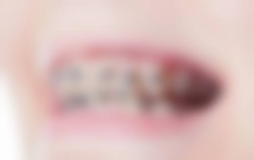 通辽付立民口腔常见问题FAQ