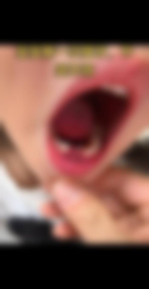 总结