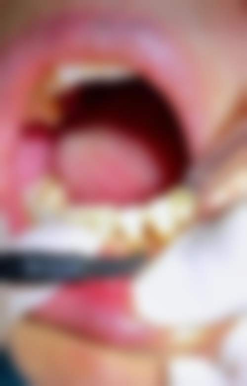 天津津诚口腔塘沽门诊部常见问题FAQ
