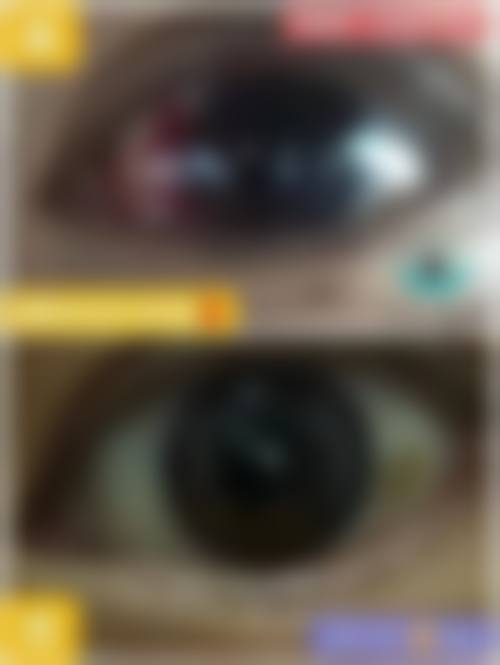 厦门大学附属翔安医院眼科怎么预约？