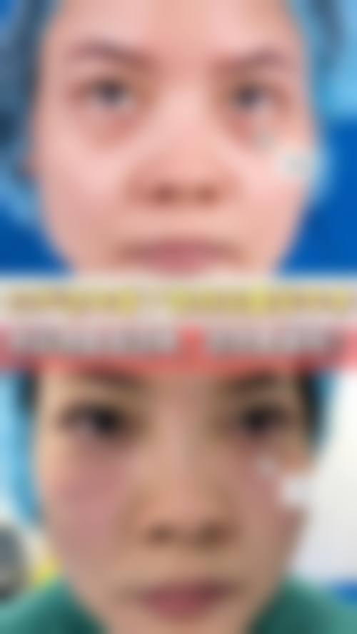 总结