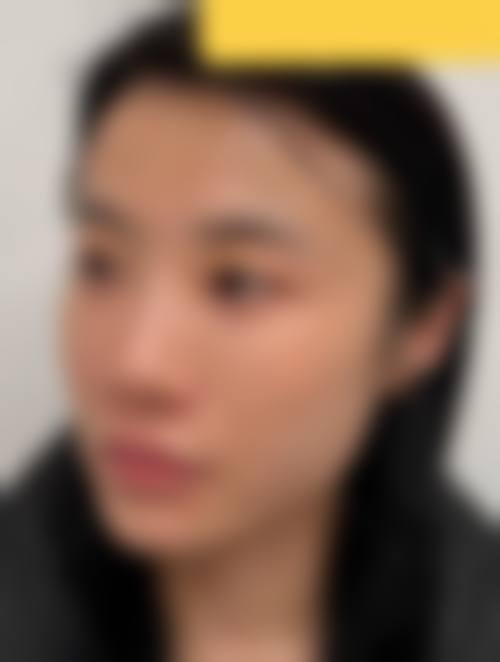 西安利兹美医疗美容诊所(轻医美)擅长项目
