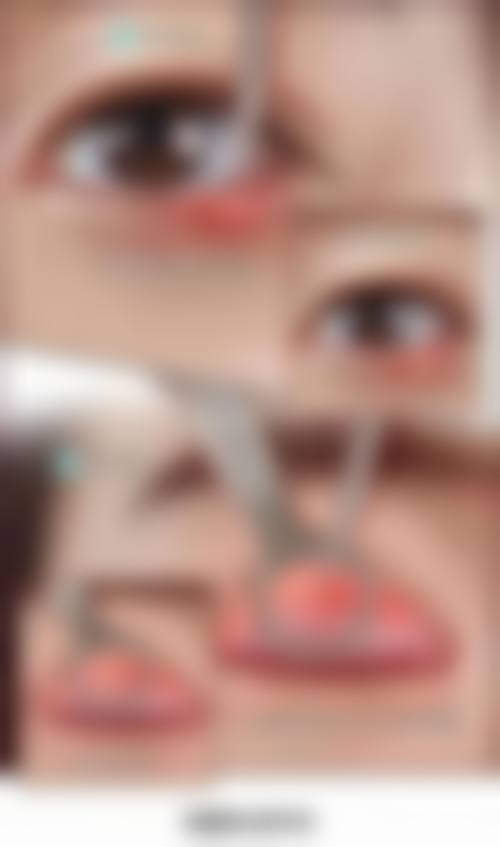 总结