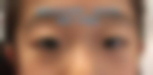 南京宁益眼科中 心门诊部擅长项目