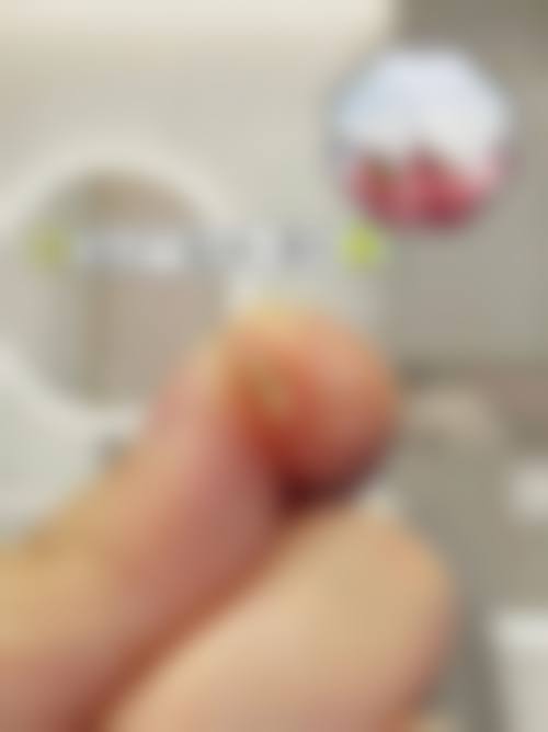总结