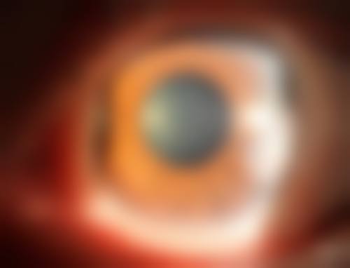 海安市人民医院眼科常见问题FAQ