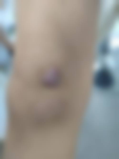 沈阳刘红医疗美容诊所擅长项目
