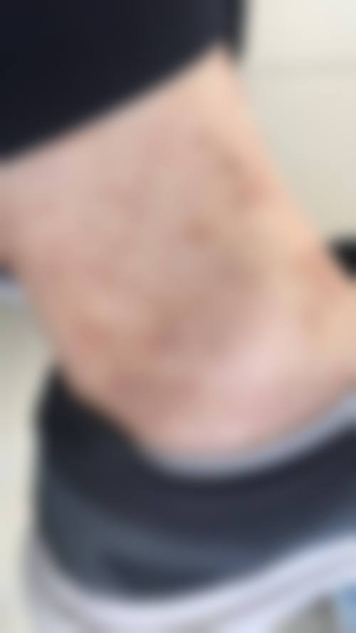 总结