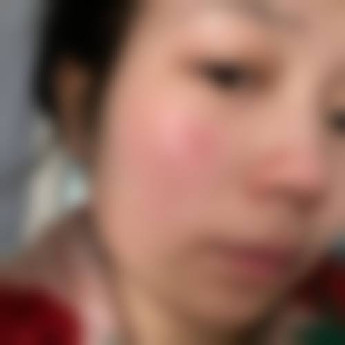 沈阳刘红医疗美容诊所怎么预约?
