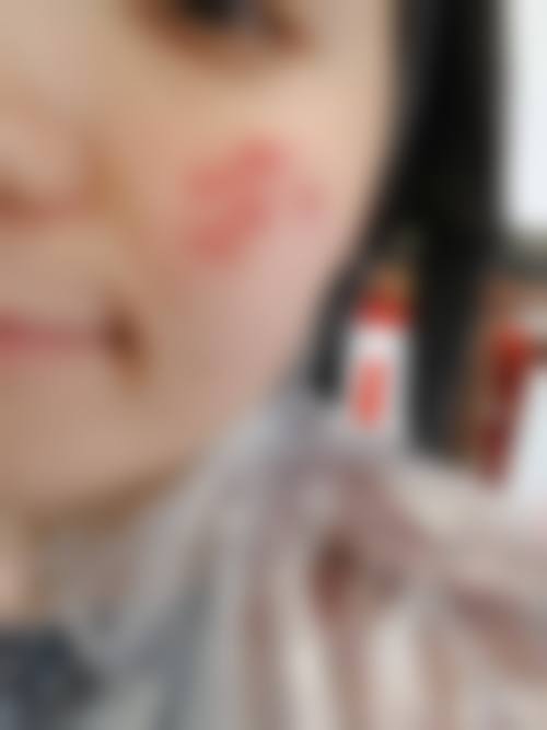 2026宁波亦美医疗美容诊所价格表（仅供参考）