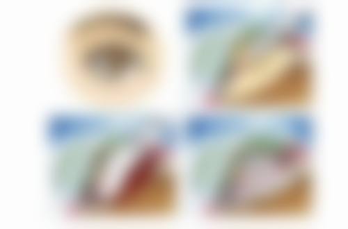 兴义市人民医院眼科常见问题FAQ