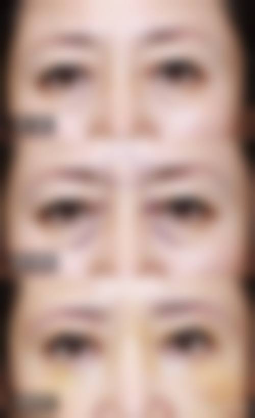 株洲安娜医疗美容门诊部常见问题FAQ