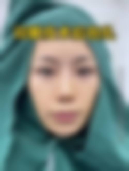 临沂丽滋汇整形医院常见问题FAQ