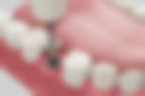 武都区瑞尔口腔诊所常见问题FAQ
