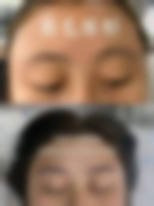 乌鲁木齐阳光天使整形医院常见问题FAQ