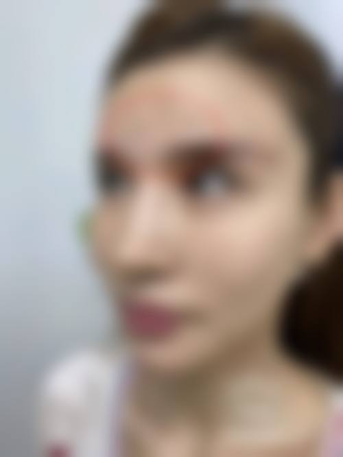 2026南京溧水羽兮医疗美容诊所价格表（仅供参考）