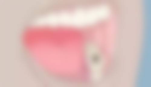 温州平阳昆阳张曼莉口腔擅长项目