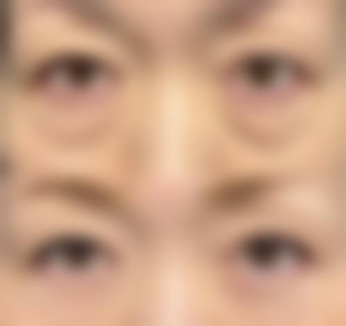 成都高新花一棠医疗美容医院常见问题FAQ