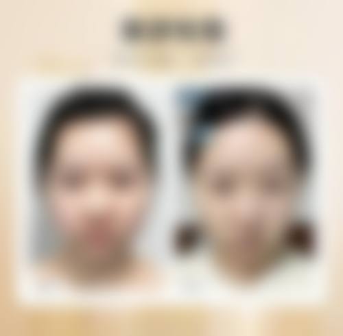 总结