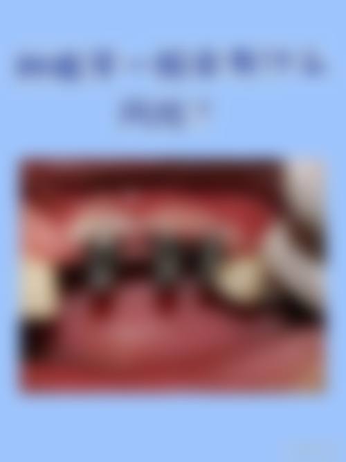 肥城微笑口腔擅长项目