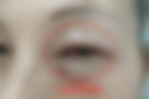 总结