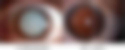 平邑县中医医院眼科常见问题FAQ