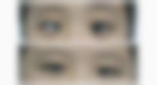 湘潭爱尔眼科医院常见问题FAQ