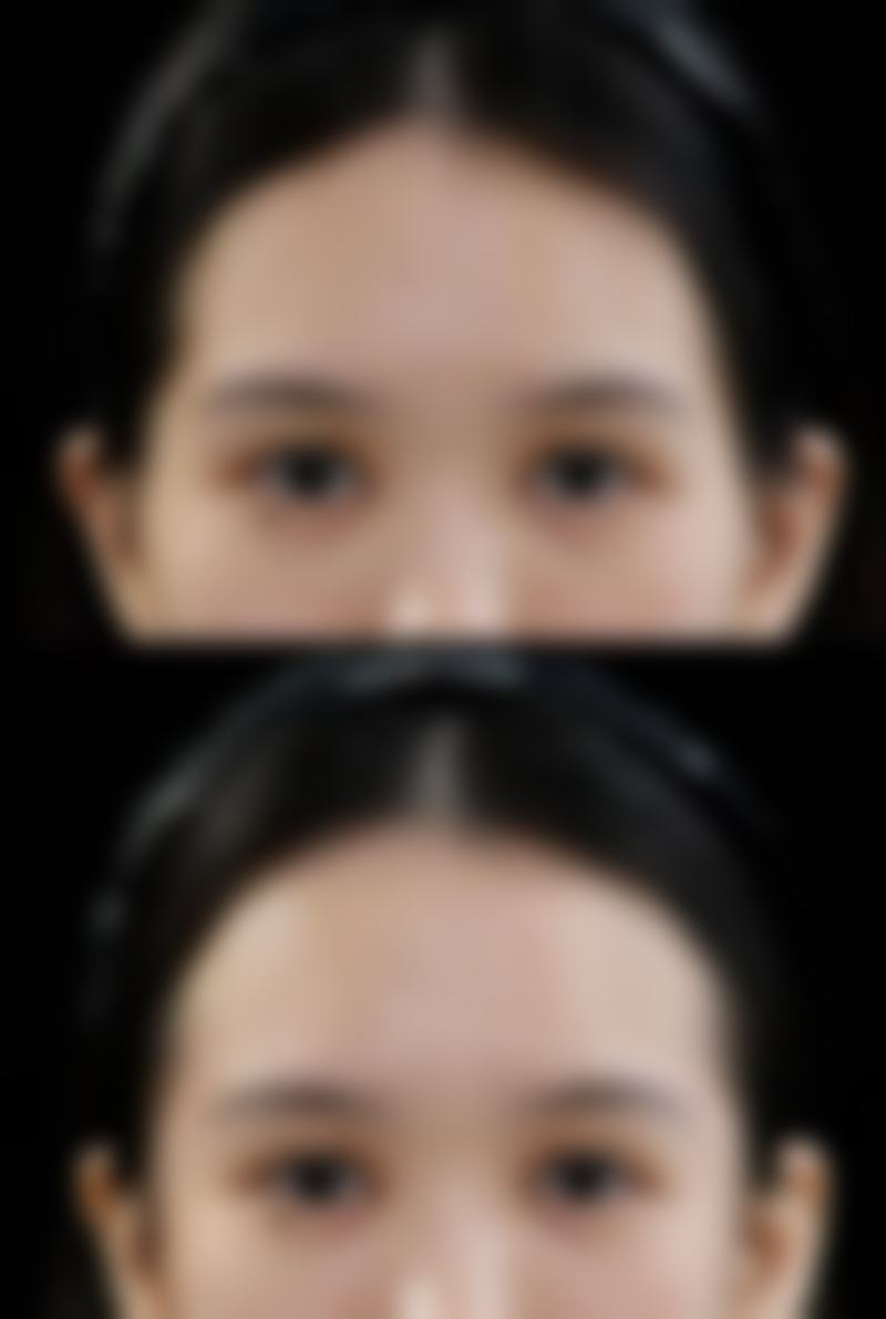 泰安佳美医疗美容怎么预约？