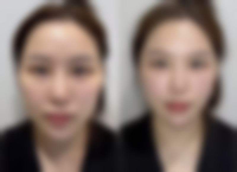韩国希克丽整形外科医院怎么预约？