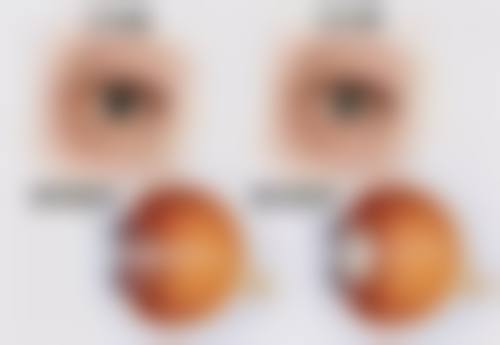 黄骅眼科医院真实患者口碑评价汇总