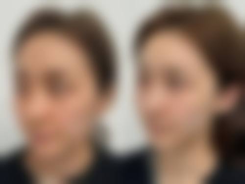 上饶安美菲丽医疗美容门诊部预约挂号方式