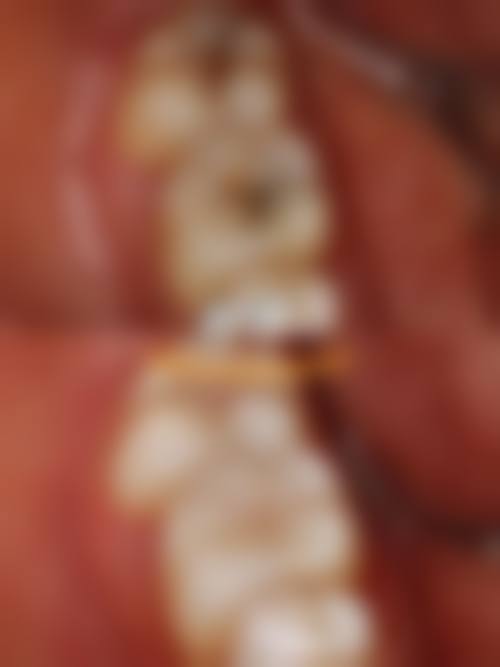天津凯尔口腔医院&王亚珍口碑评价