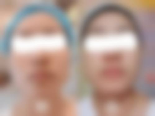 长沙静岚整形医院擅长项目