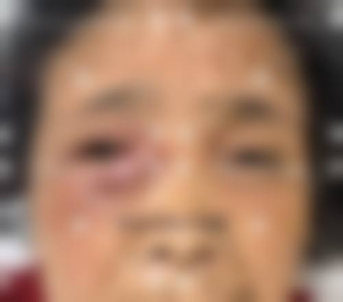 哈尔滨市儿童医院眼科怎么预约?