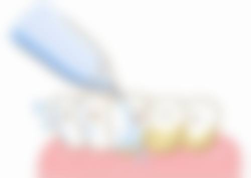 武汉大众口腔后湖店具备什么实力