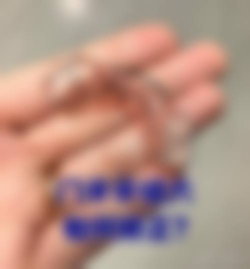 江苏苏州洁雅口腔诊所常见就医快问快答