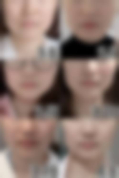 宜春爱丽仕整形医院擅长项目