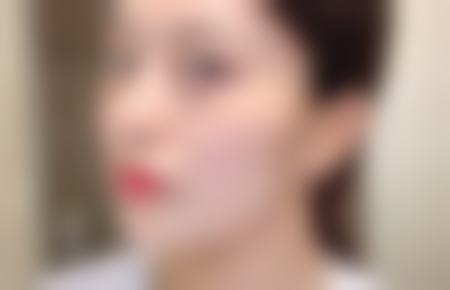成都优莱擅长项目聚焦精细化整形