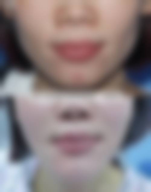 日本Mods美容外科医院常见问题FAQ
