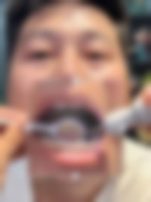 2026安徽淮北薛继飞口腔价格表(仅供参考)
