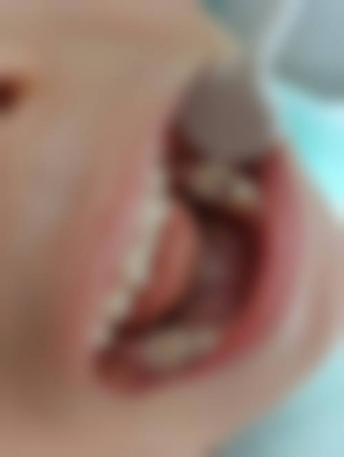 总结