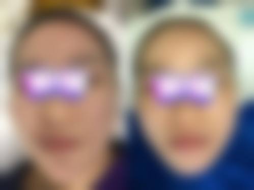 惠州馨依人医疗美容诊所擅长项目
