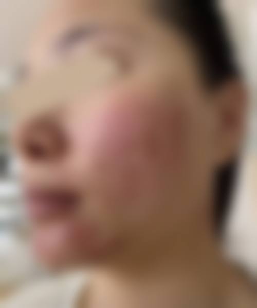 总结