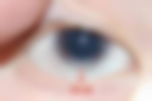 西安渭北眼科医院擅长项目