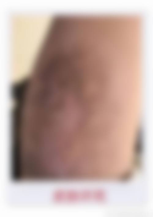 总结