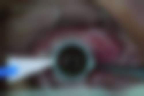 关于青岛福柏眼科医院(莱西院)的快问快答